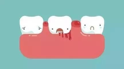 牙龈出血的原因是什么 怎么缓解