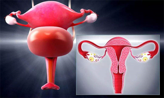如何保养卵巢 药膳预防卵巢早衰